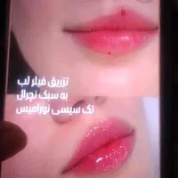 تزریق فیلر به روش mdcodes|خدمات آرایشگری و زیبایی|اسلام‌شهر, شهرک واوان|دیوار