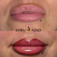 آموزش تخصصی میکروپیگمنتیشن|خدمات آموزشی|بجنورد, |دیوار