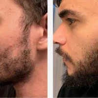 دنبالش نگرد پیشه منه