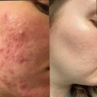 کرم وی ای پی اصل صدرصد تضمینی و بدون بازگشت|آرایشی، بهداشتی، درمانی|یاسوج, |دیوار