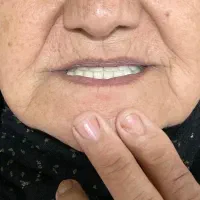 ساخت دندون مصنوعیی|پزشکی|گرگان, |دیوار