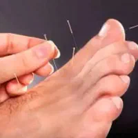 ماساژ..طب سوزنی.مزاج شناسی