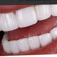 ایمپلنت با قیمت باور نکردنی