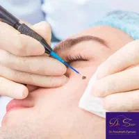 مرکز تخصصی(زگیل تناسلی کرایو فریز)میخچه وشت اضافی|خدمات آرایشگری و زیبایی|اهواز, گلستان|دیوار