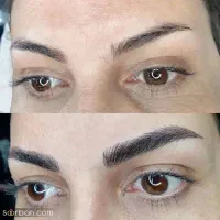 مدل میکروبلیدینگ و میکروپیگمنتیشن