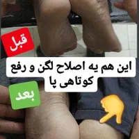 رگگیری.اصلاحی.زالودرمانی.حجامت.اصلاحی|خدمات آرایشگری و زیبایی|کاشان, دشت چال|دیوار