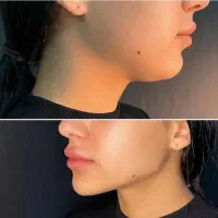 تخفیفات کلینیک زیبایی