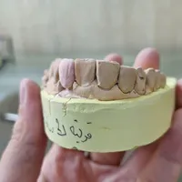سلام کسی هست که در حوزه دندانسازی تازه وارد شده