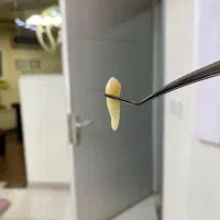 فروش دندان های خلفی4.5سالم|پزشکی|رشت, سعدی (تختی)|دیوار