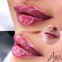 نیازمند مدل بوتاکس و ژل.اموزش ژل و بوتاکس