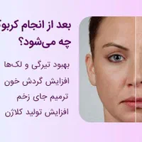 مدل کربوکسی تراپی صورت در کلینیک پوست فاز۲