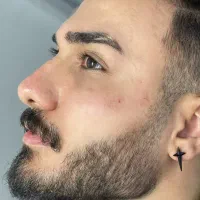 بوتاکس فیلرژل لب گونه چانه زاویه فک و صورت مادلینگ|خدمات آرایشگری و زیبایی|تهران, تهرانپارس غربی|دیوار