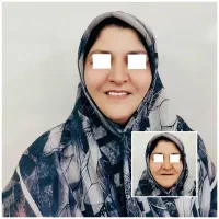 ساخت دندان مصنوعی طرح لمینت با قیمت اقتصادی|خدمات آرایشگری و زیبایی|یزد, |دیوار