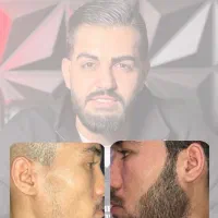 ریش پرپشت و مردونه