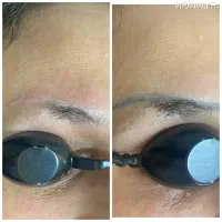 لیزر کیوسوئیچ (رفع لک صورت.رفع لک زیربغل.رفع تتو)|خدمات آرایشگری و زیبایی|رشت, پورسینا|دیوار