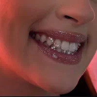 انجام کلیه خدمات نگین و دیزاین دندان فقط ۳۴۰ تومان