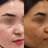ضدلک/نمایندگی/تحویل حضوری