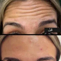 جشنواره  تخفیفات خدمات زیبایی