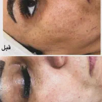 ۳۰ درصد تخفیف روی تمام خدمات پوستی