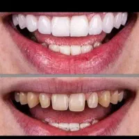 دندانپزشکی|خدمات آرایشگری و زیبایی|قم, دورشهر|دیوار