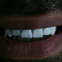 خدمات تخصصی دندانسازی ساخت دندان مصنوعی ژله ای|خدمات آرایشگری و زیبایی|اندیشه, اندیشه فاز ۱|دیوار