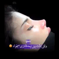 عمل بینی و جراحی لیپوساکشن با تیم پزشکان|خدمات آرایشگری و زیبایی|تهران, فلسطین (میدان انقلاب)|دیوار