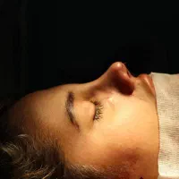 جراحی بینی فقط ۳۹ تومان