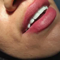 منشی دندانسازی