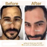 کرم فوقالعاده قوی ویکتور قیمت یک میلیون .|حراج|بروجرد, |دیوار