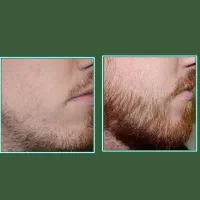 بعد ۳۰ روز ریشاتو دیدی زیارتت قبول