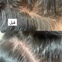اسکراب و پاکسازی تخصصی کف سر /درخشش و رشد مو|خدمات آرایشگری و زیبایی|صدرا-فارس, فاز ۱|دیوار