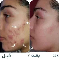 کرم معجزه اصل|آرایشی، بهداشتی، درمانی|یزد, |دیوار