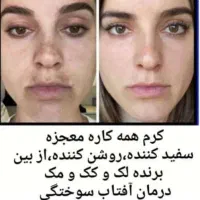 کرم معجزه 43ترکیبه عماراتی|آرایشی، بهداشتی، درمانی|شیراز, سلطان آباد|دیوار
