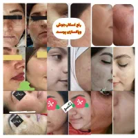 تخفیفات بلک فرایدی فقد تا دوازده امشب