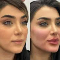 مدل برای مربی ژل سیسی 399 مواد کره ای اصل