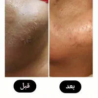 لیزر و زیبایی خمینی شهر|خدمات آرایشگری و زیبایی|خمینی‌شهر, |دیوار