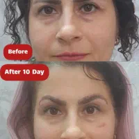 تخفیف ویژه