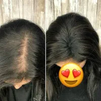 روغن های درمانی