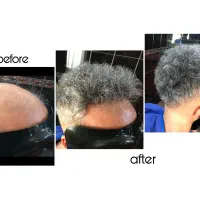 خانه موی ایران ،پروتز مو ترمیم مو انجام کلیه خدمات