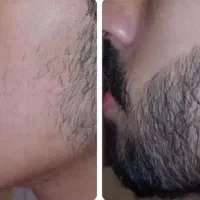 حس خوب رویش