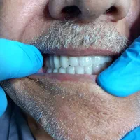 کار اموز لابراتوار ساخت دندان