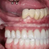 دندانپزشکی  تخصصی ترین مرکز ایمپلنت و جراحی|خدمات آرایشگری و زیبایی|ورزقان, |دیوار