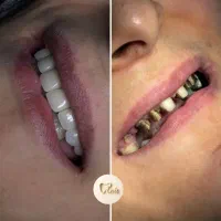 دندان پزشکی|خدمات آرایشگری و زیبایی|قم, نوقطار|دیوار