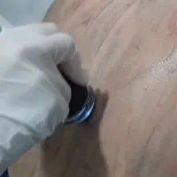 جشنواره پلاژن تراپی صورت و بدن|خدمات آرایشگری و زیبایی|شیراز, قصرالدشت|دیوار