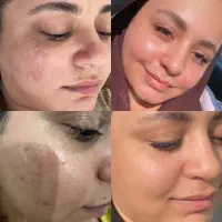 کرم ضد لک لاکچری کوین