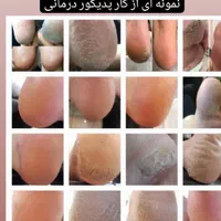 پدیکور درمانی وکفسابی vip با بروز ترین متد دنیا|خدمات آرایشگری و زیبایی|اردبیل, |دیوار