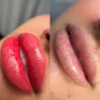 انجام تخصصی فیبروز و میکروبلیدینگ +آموزش+مدرک|خدمات آرایشگری و زیبایی|اهواز, گلستان|دیوار