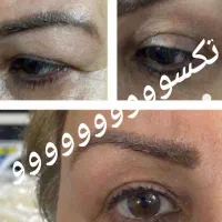 رفع تیرگی ، ناباروری،  چاقی صورت و بدن ، لاغری|آرایشی، بهداشتی، درمانی|زاهدان, |دیوار