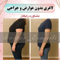 جشنواره لاغری امبدینگ/ایمپلنت لاغری/مزوتراپی لاغری