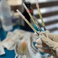 آموزش prp و prf لیفت نخ سابسیژن
